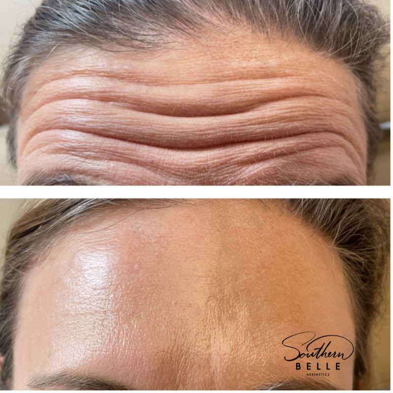 Southern Belle Aesthetics Co, spa in Maryville, TN, photo 2 of 10